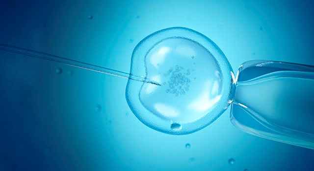 In Vitro Fertilization