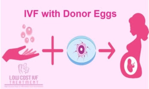 IVF with Donor Eggs